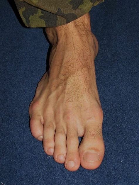pin on bare feet