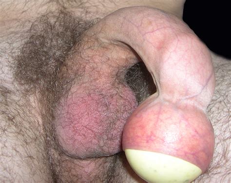 docking i put a billard ball into my foreskin fetish porn pic