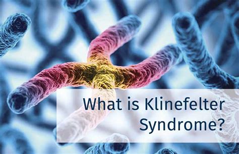 Klinefelter Syndrome – Facts To Know New Life Ticket