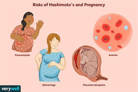 hashimoto s disease and pregnancy fertility gestation