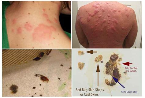 Bed Bug Treatment And Extermination Cost Guide How Much