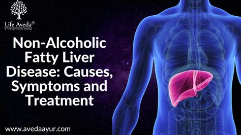 Non Alcoholic Fatty Liver Disease Causes Symptoms And Treatment