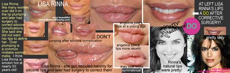 permanent lip augmentation beauty tips makeup over40 plastic surgery