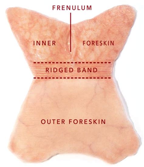 Foreskin Infection