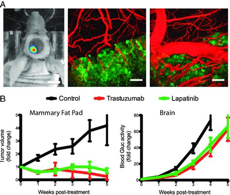 Imaging Of The Breast Cancer Brain Metastasis Model And The Effect Of