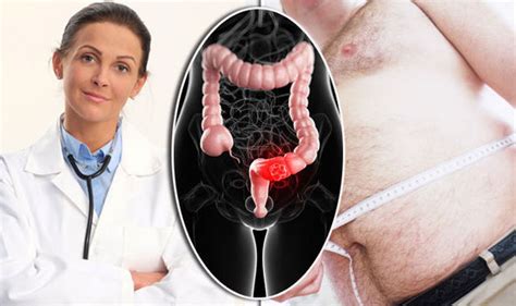 bowel cancer symptoms how this body measurement could predict your