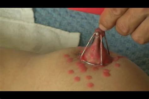 Nipple Stretching And Waxing Xhamster