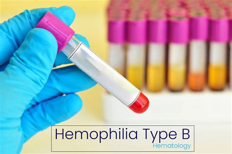 hemophilia b causes inheritance diagnosis and treatment medcrine