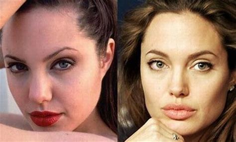 stars before and after plastic surgery 47 pics