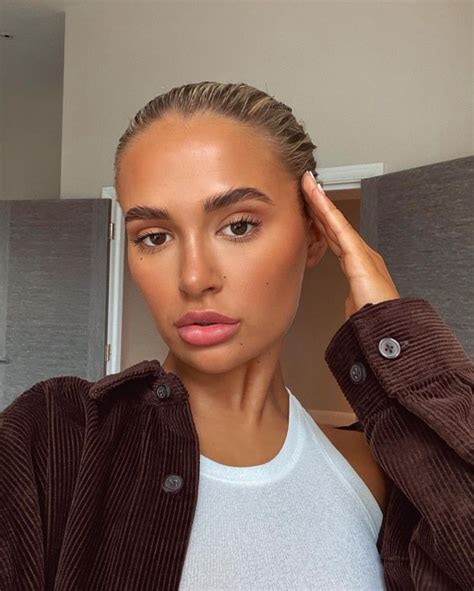 Molly Mae Hague Reveals Natural Lips After Having Lip Filler Dissolved