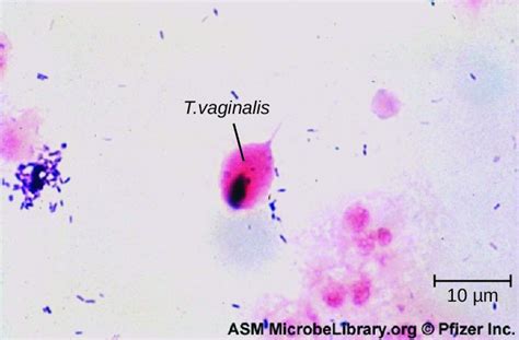 Protozoan Infections Of The Urogenital System Microbiology