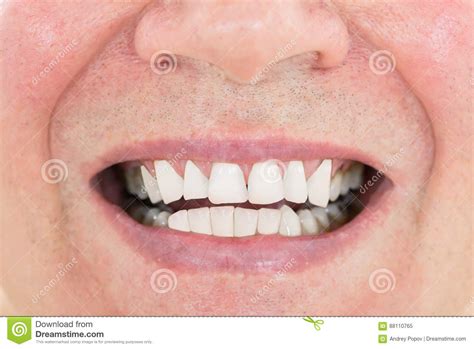 senior man showing  teeth stock image image  gingiva cavity