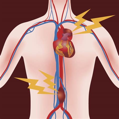 aneurysma orthopress das neue onlineportal rund um ihre gesundheit