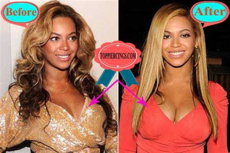 Beyonce Plastic Surgery Beyonce Before And After Teeth