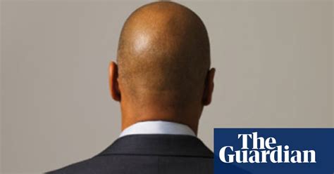 Dr Luisa Dillners Guide To…baldness Health And Wellbeing The Guardian