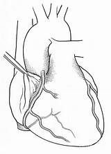 Coronary Photograph sketch template