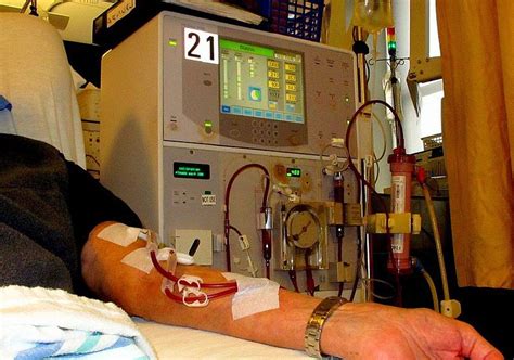 fears  dialysis unit privatisation shropshire star