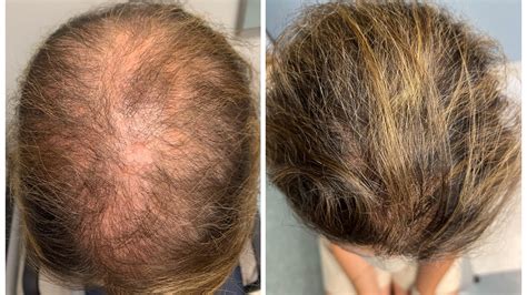 natural hair regrowth deals outlet save  jlcatjgobmx