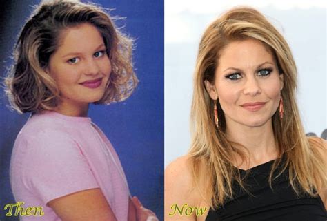 Candacecameron Plastic Surgery Before And Pictures