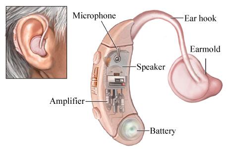 listen clear  iphone hearing aids    buy
