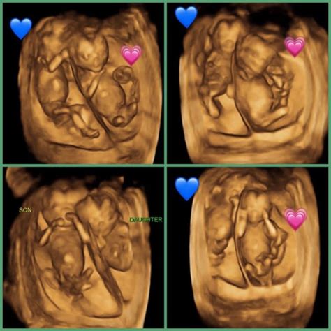 ultrasound testimonials   ultrasound  ft myers fl
