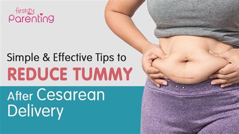 Effective Tips To Reduce Belly After A C Section Delivery Youtube