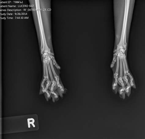 Cat Paw X Ray Declawed Cat Meme Stock Pictures And Photos