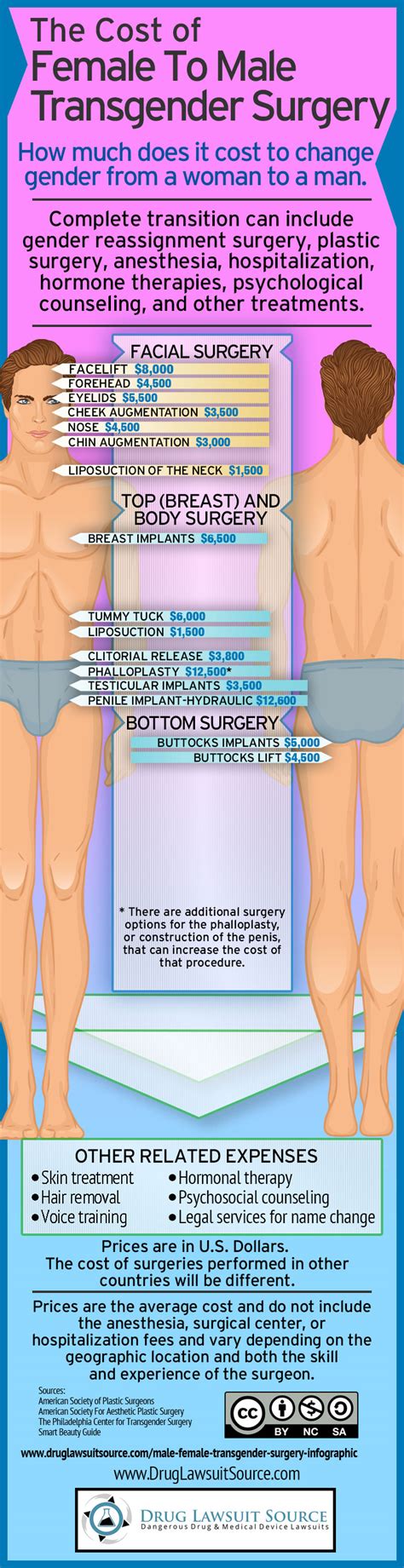 Transgender Surgery Cost Infographic Female To Male Sex