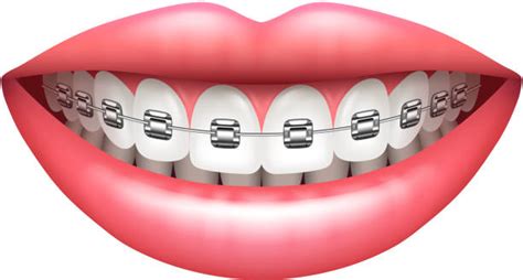 Orthodontist Illustrations Royalty Free Vector Graphics And Clip Art
