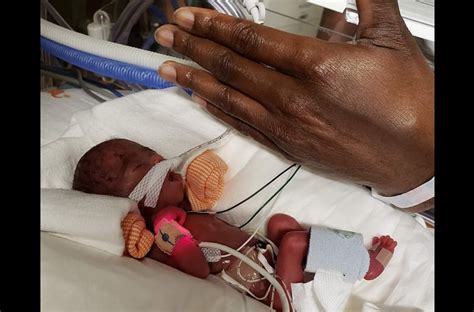 week  premature baby weighing   ounces  birth  home