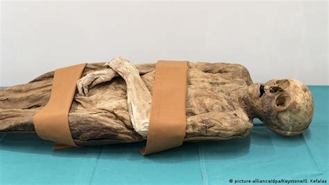 Syphilis Ridden Swiss Mummy Identified As Boris Johnson′s Ancestor