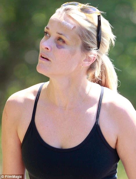 Reese Witherspoon Shrugs Off Her Injuries As She Takes Up Jogging Again