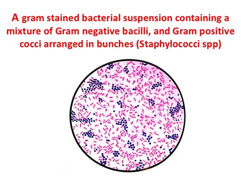 Gram Positive Vs Negative Bacteria