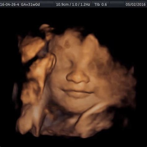 babies bellies dd ultrasound studio    reviews
