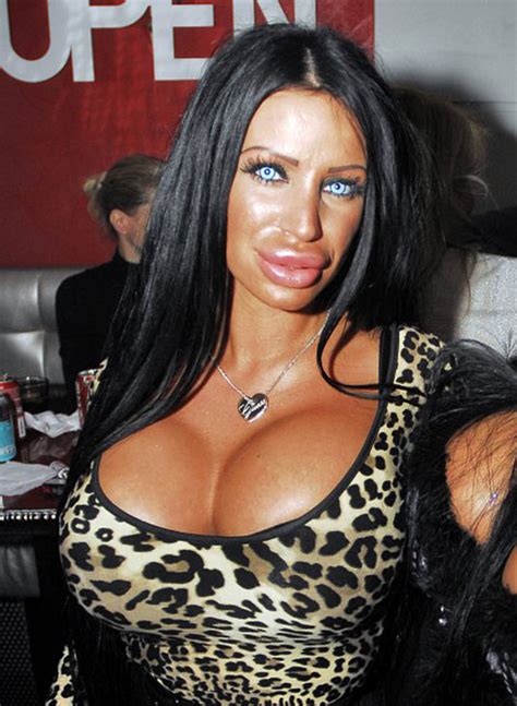 Zombie Girls When Plastic Surgery Goes Wrong Hawtcelebs