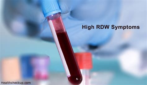 high rdw symptoms  test treatment health checkup