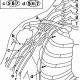 Brachial Plexus sketch template