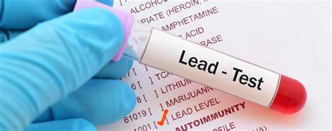 screening  lead  practices