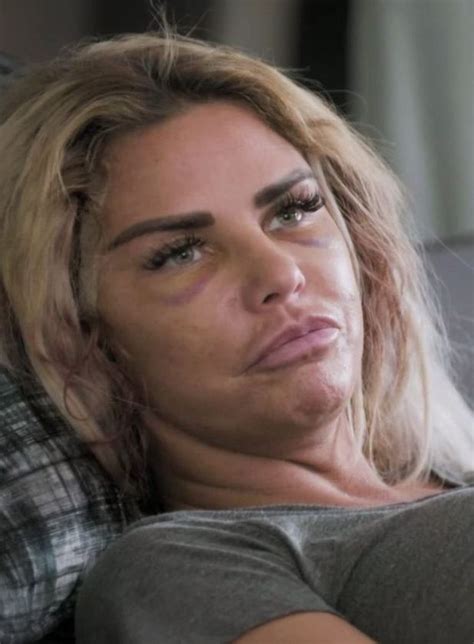 kerry katona says katie price has crossed line with awful cosmetic