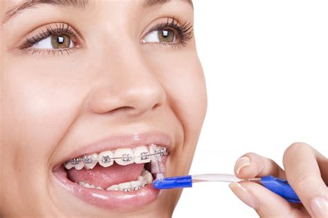 tips  keeping  braces clean orthodontist  henderson nv