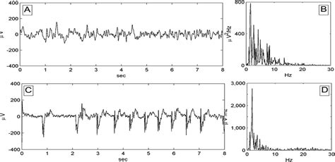 ictalinterictal continuum journal  clinical neurophysiology