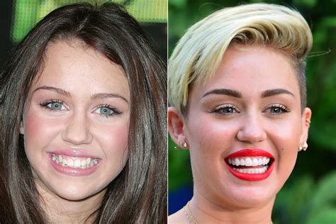 celebrities  dental      toothy