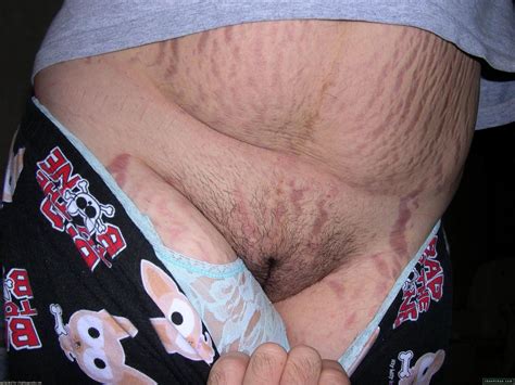 stretch mark pussy 66919 stretch mark 1 vagina 225 fugly