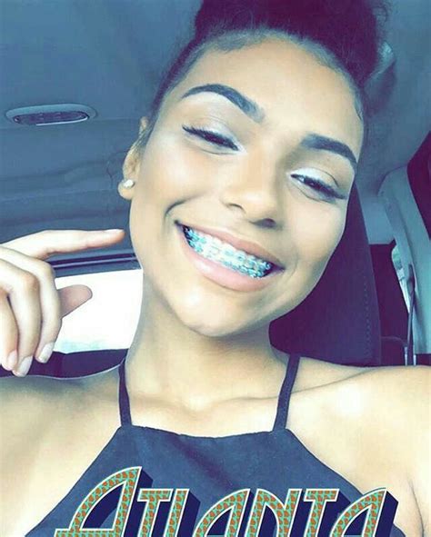 Cute Braces Colors For Light Skins Houses And Apartments For Rent