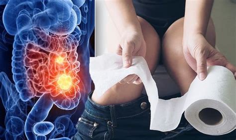 Bowel Cancer Symptoms Signs Of A Tumour In The Toilet Include Having