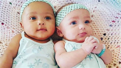 ’love Is Love’ Biracial Twins Born In Illinois With Different Skin
