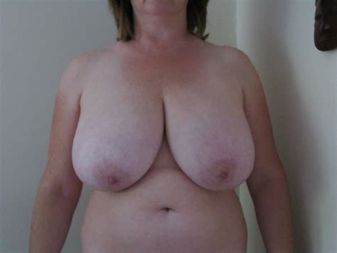 pre breast reduction tits 2 94 pics xhamster