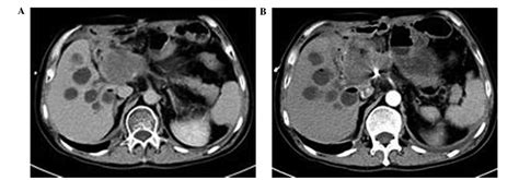 case report real time contrast enhanced ultrasonography for the