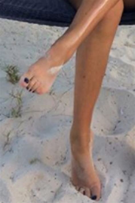 Megan Mckenna Trolled Over Her Stump Toes Ok Magazine