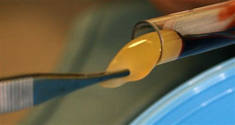Postpone root canal